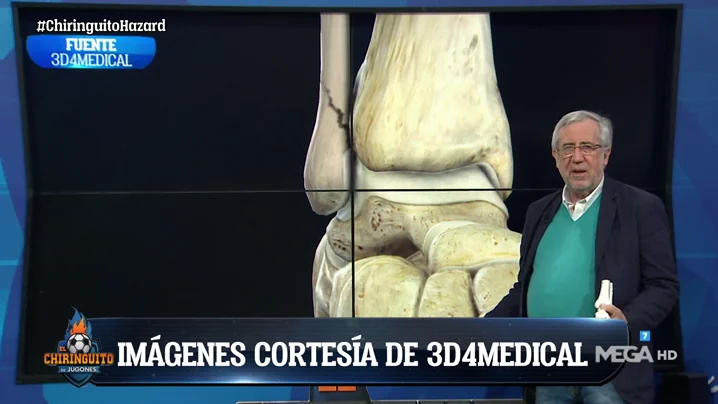 Nuestro traumatólogo, Pablo de Lucas, analiza la lesión de Hazard Nuestro traumatólogo, Pablo de Lucas, analiza la lesión de Hazard