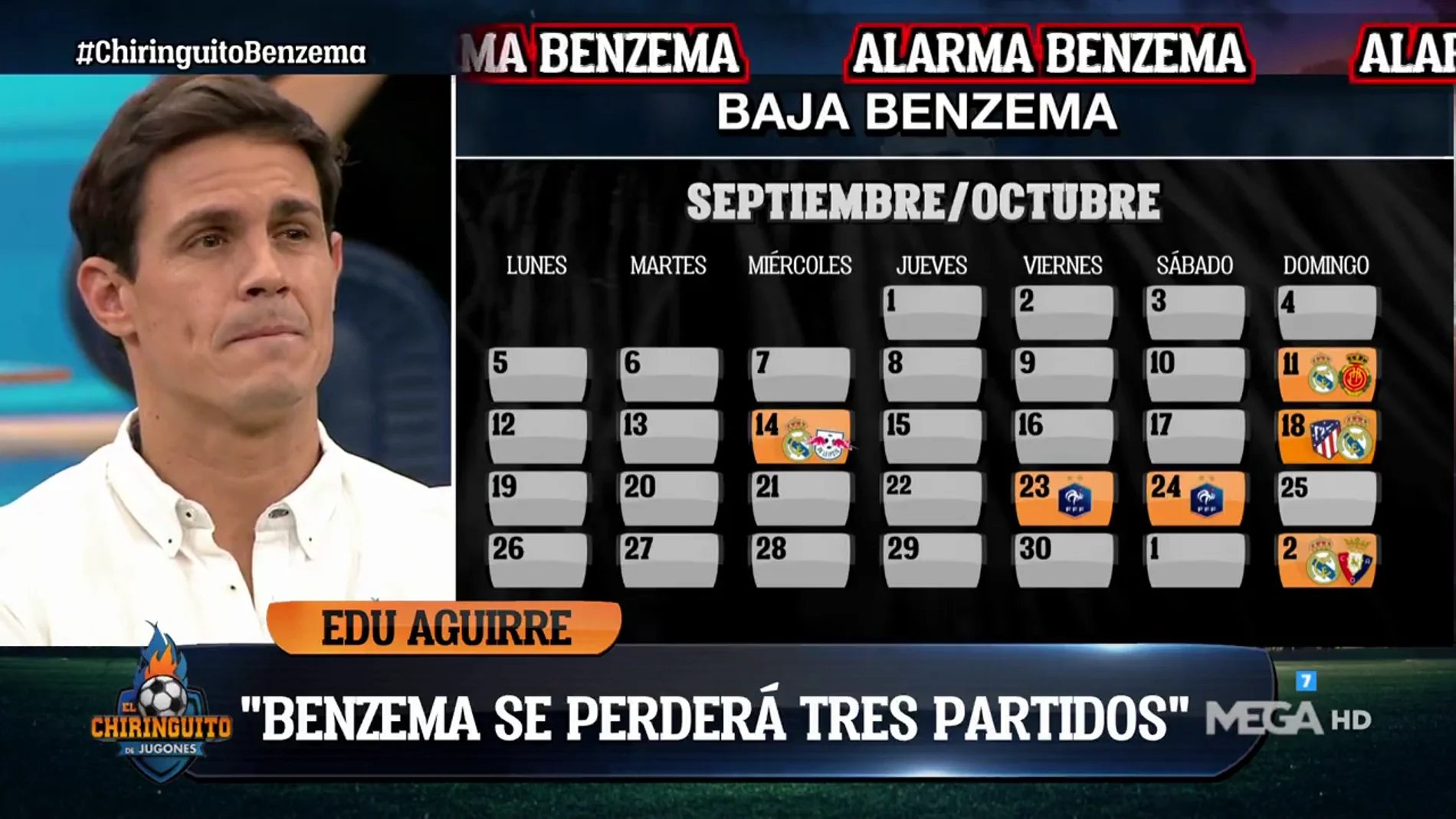 Este será el tiempo que Benzema estará de baja