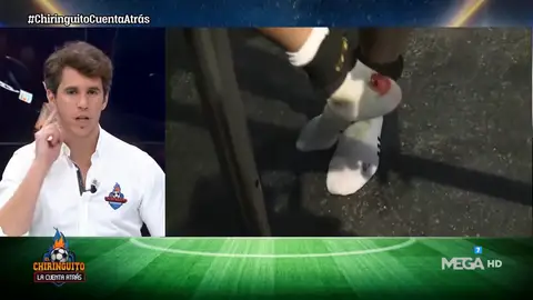 Joselu, con el tobillo ensangrentado, explica su perdón al Bernabéu Joselu, con el tobillo ensangrentado, explica su perdón al Bernabéu