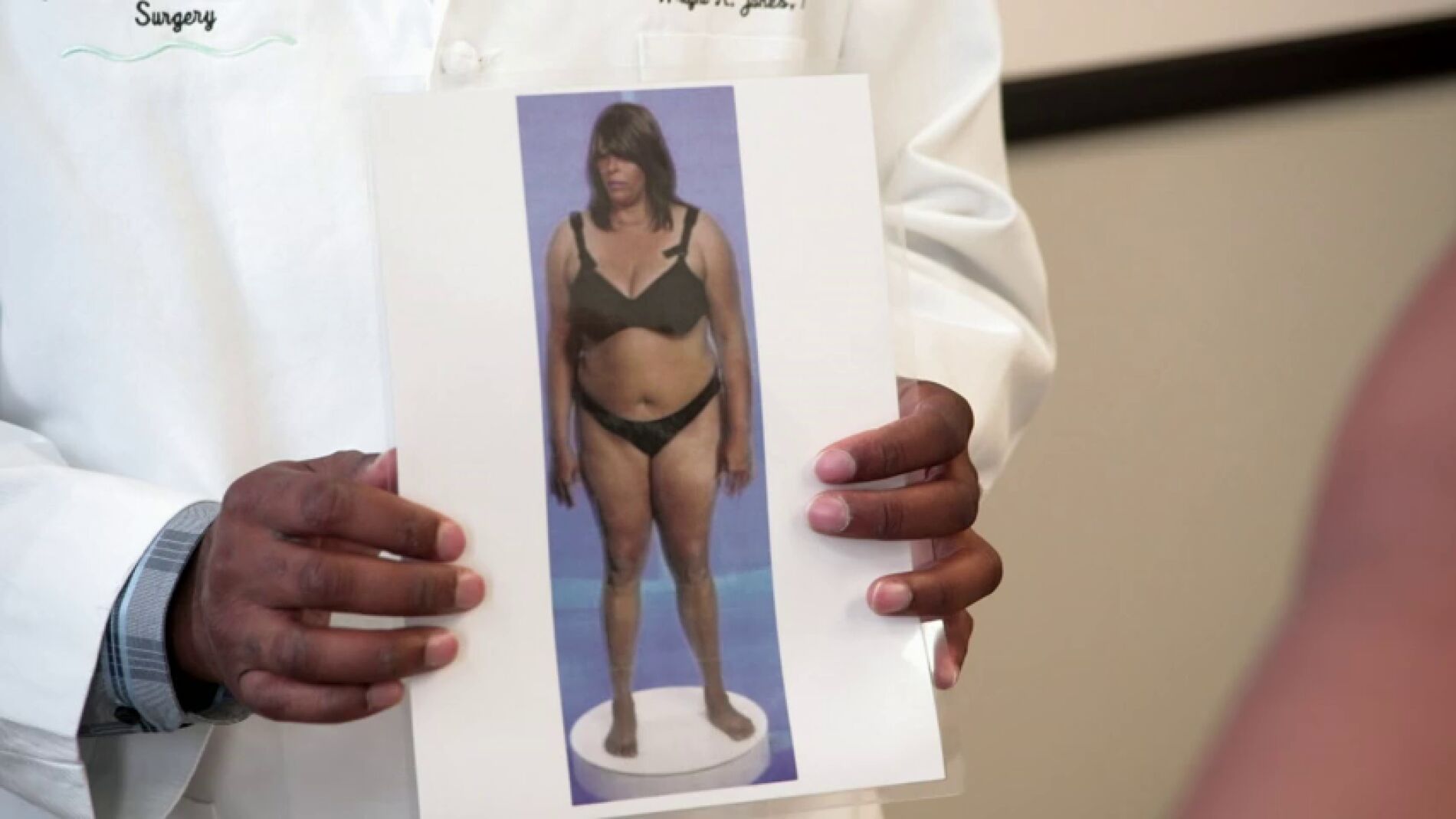 Frame 0.0 de: El antes y el despu&eacute;s tras una ciruj&iacute;a pl&aacute;stica completa