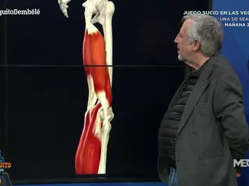 Pablo de Lucas, nuestro traumatólogo, explica la lesión de Dembeélé Pablo de Lucas, nuestro traumatólogo, explica la lesión de Dembeélé