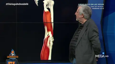 Pablo de Lucas, nuestro traumatólogo, explica la lesión de Dembeélé Pablo de Lucas, nuestro traumatólogo, explica la lesión de Dembeélé