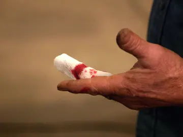 Herido en Forjado a fuego Herido en Forjado a fuego