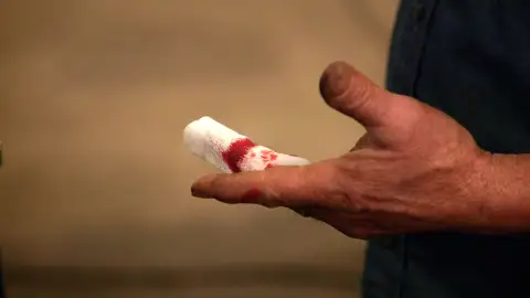 Herido en Forjado a fuego Forjado a fuego