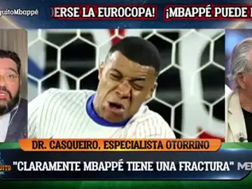 "Mbappé debería estar 10-15 días con máscara" "Mbappé debería estar 10-15 días con máscara"