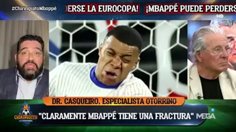 "Mbappé debería estar 10-15 días con máscara" "Mbappé debería estar 10-15 días con máscara"